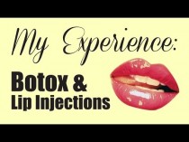 wedding photo - My Experience: Botox & Lip Injections